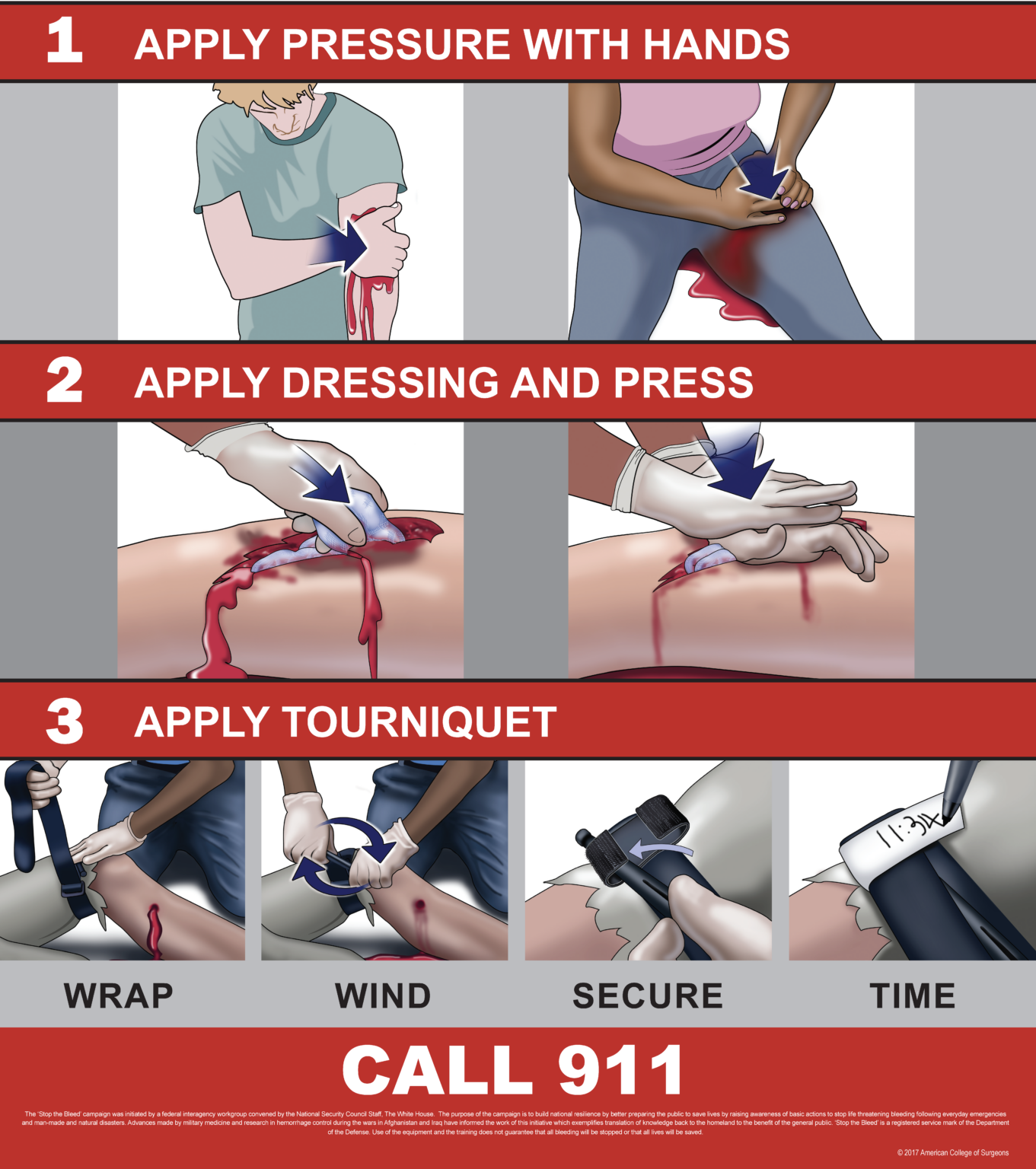 Stop the Bleed Poster